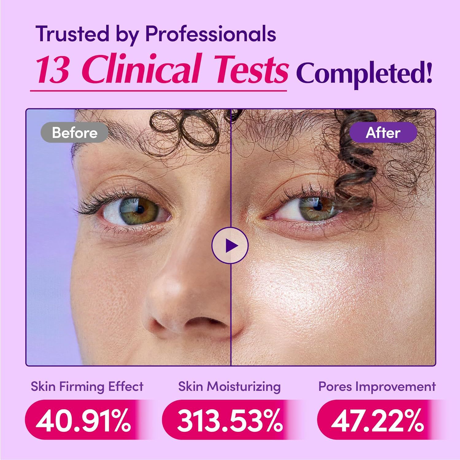 เซรั่มบาคูชิออลและวิตามินซี ช่ - Bakuchiol Retinol Alternative บทวิจารณ์และราคา